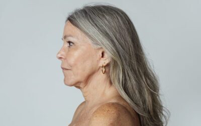 Natural Facelift Results: Why Modern Techniques Deliver Better Outcomes