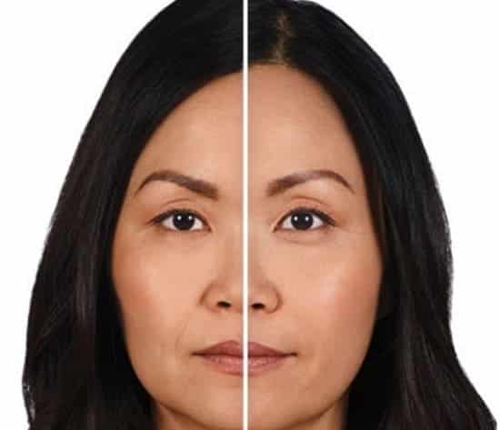 fillers-3