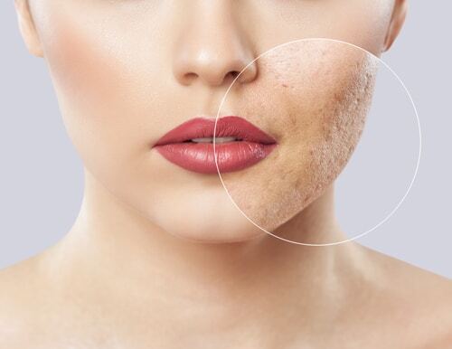fractora-services-medispa