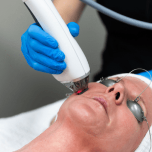 women getting laser treatment on face